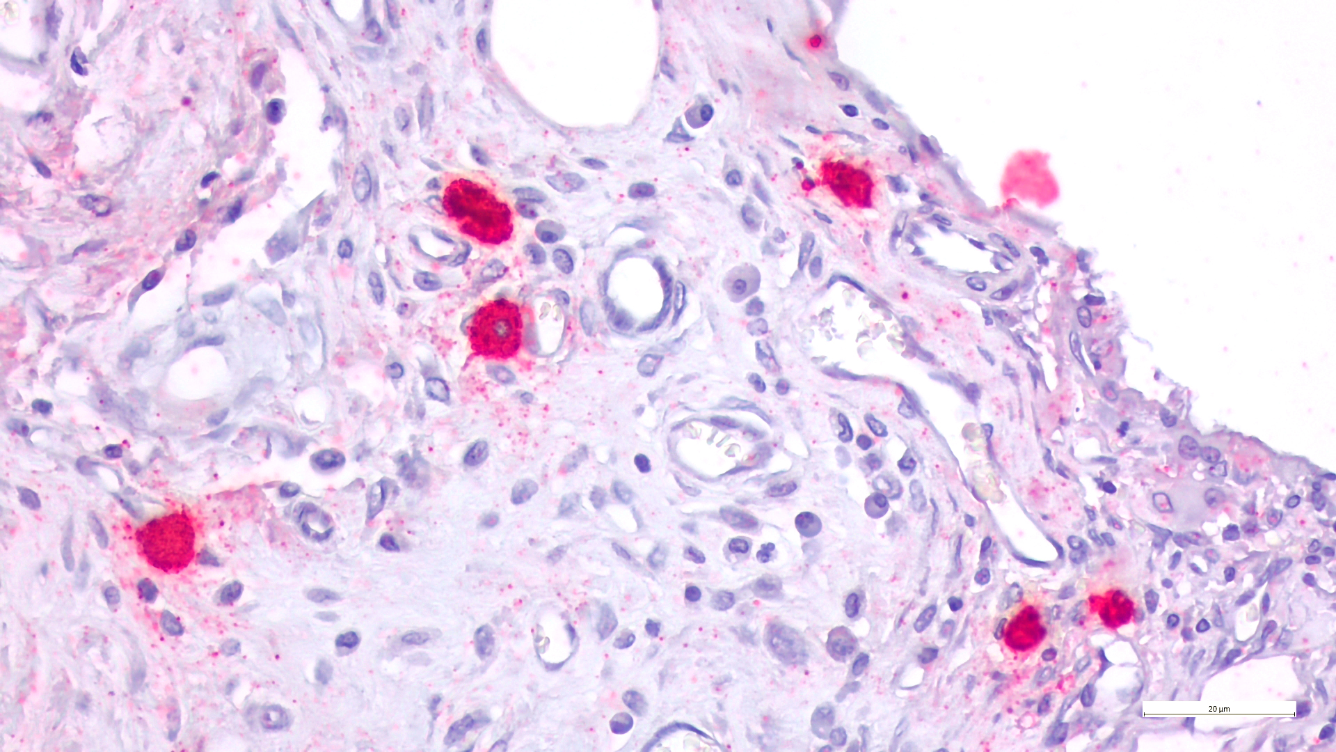 CD11c immunohistochemistry, dendritic cells in foreign-body response