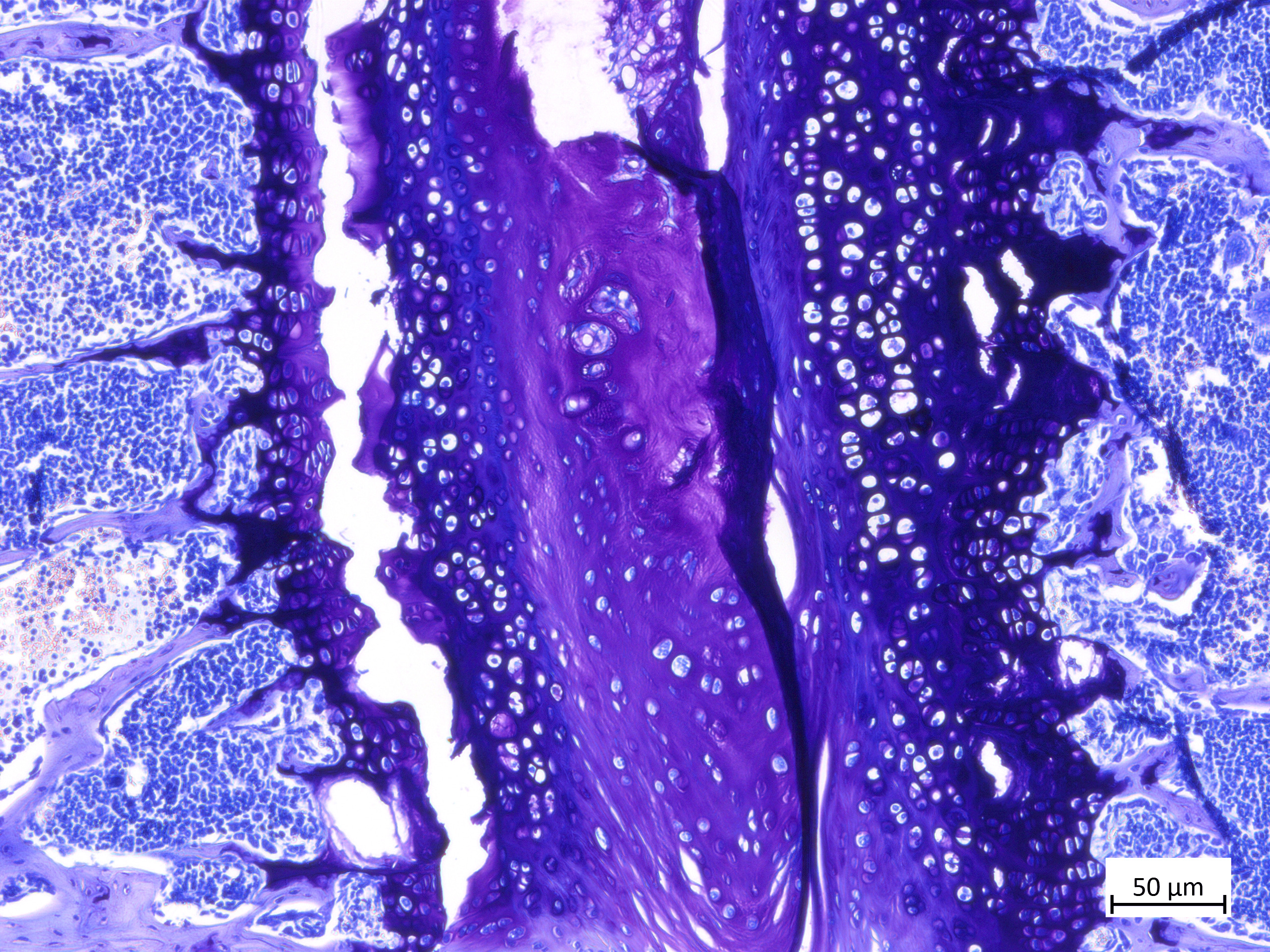 Giemsa stain, bone and bone-marrow morphology