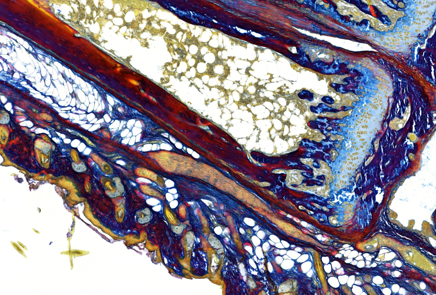 Herovici stain, young vs mature collagen