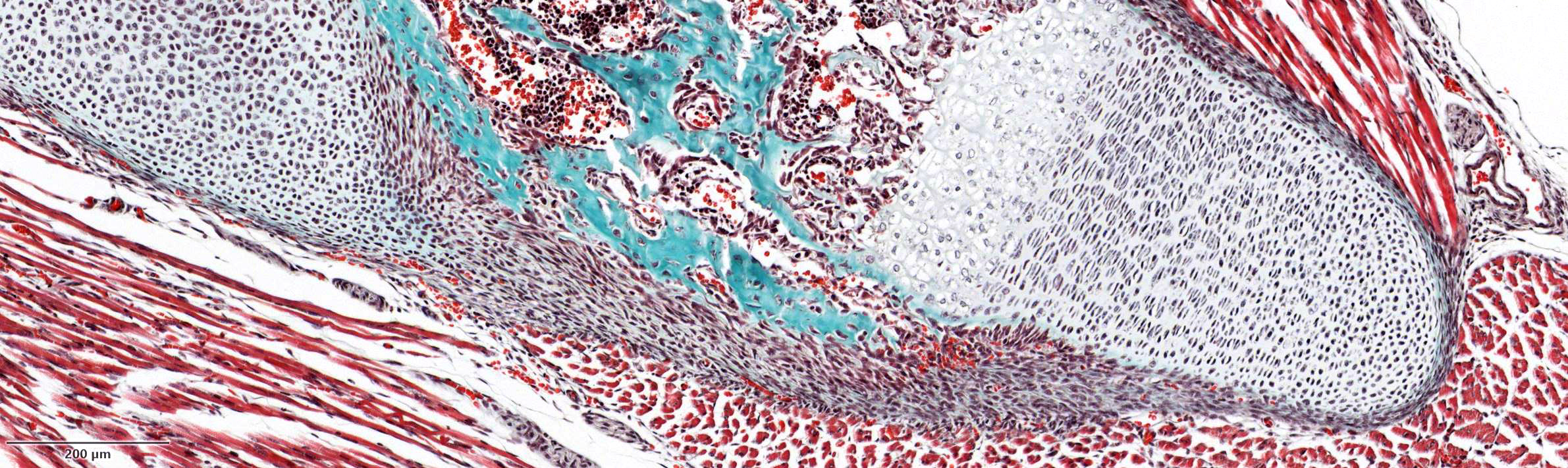 Masson-Goldner trichrome, bone, osteoid and connective tissue