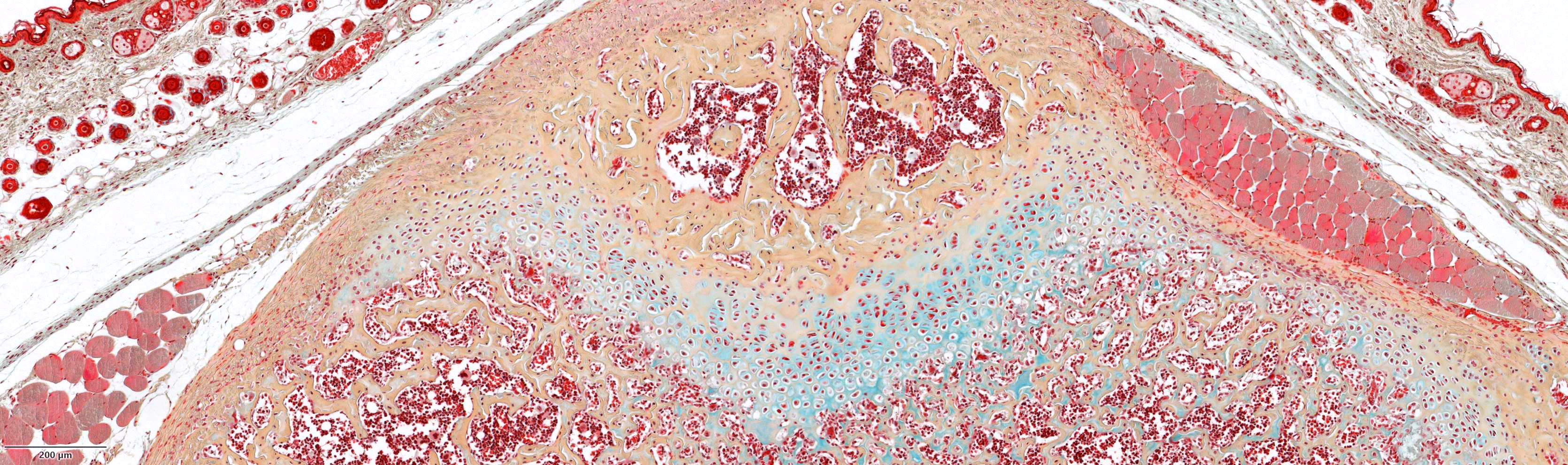 Movat pentachrome, five-colour bone, cartilage and connective tissue