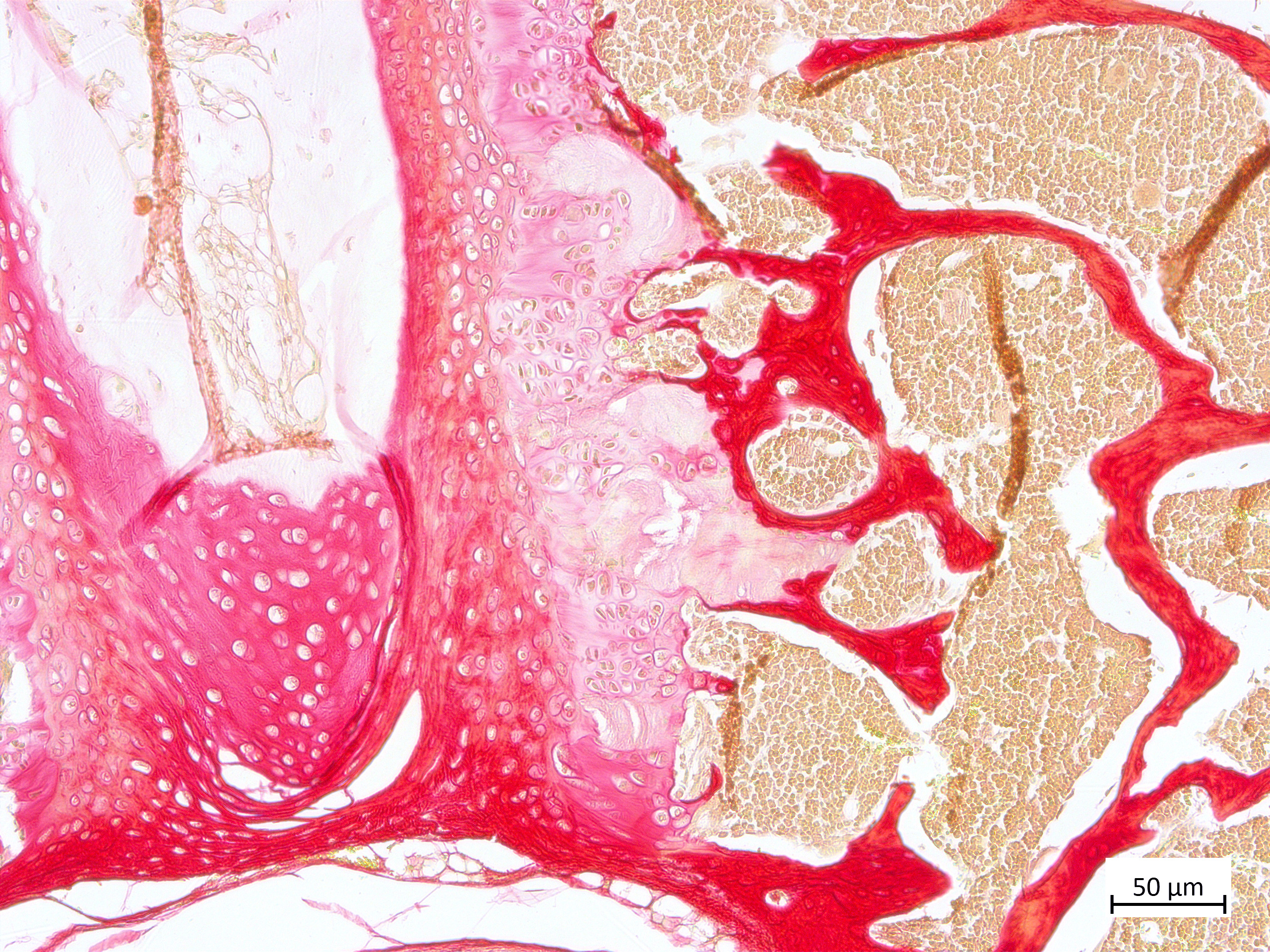 Sirius Red, total collagen network