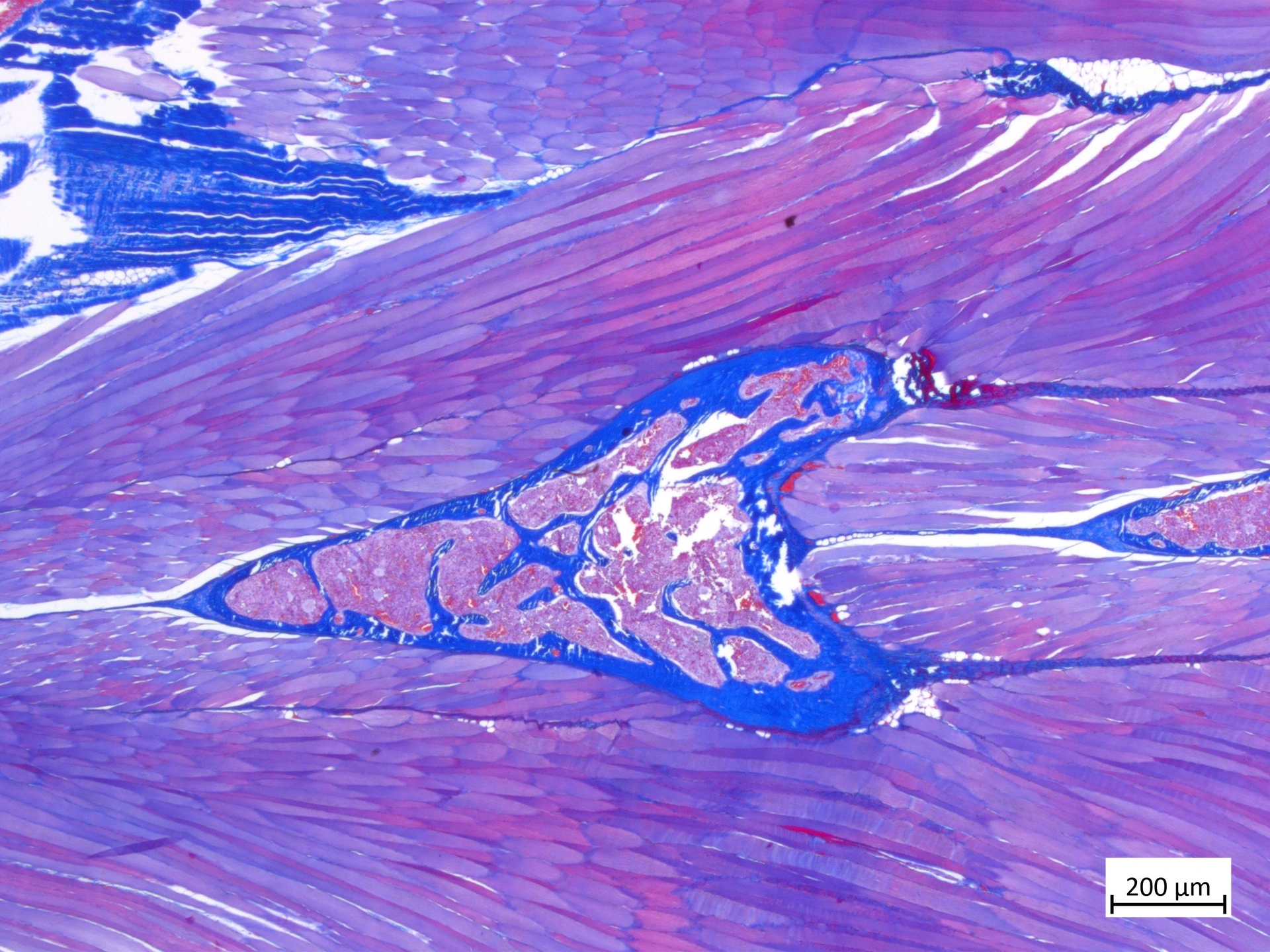 Original Azan-stained tissue section showing blue connective matrix and red-stained structures.