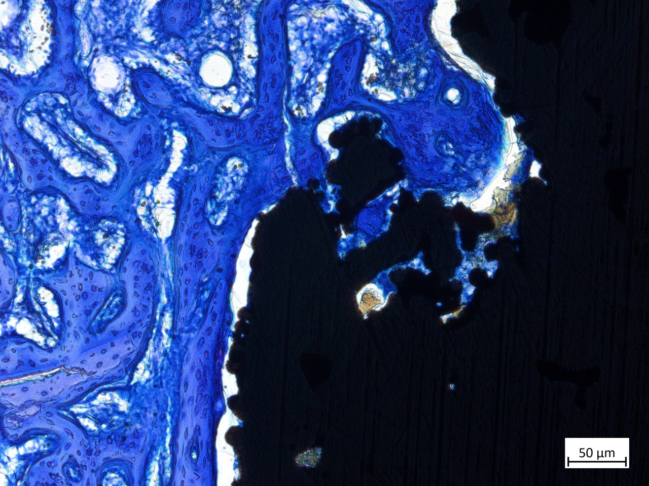 Original toluidine-blue section of an undecalcified bone and titanium interface, with a 50-micrometre scale bar.