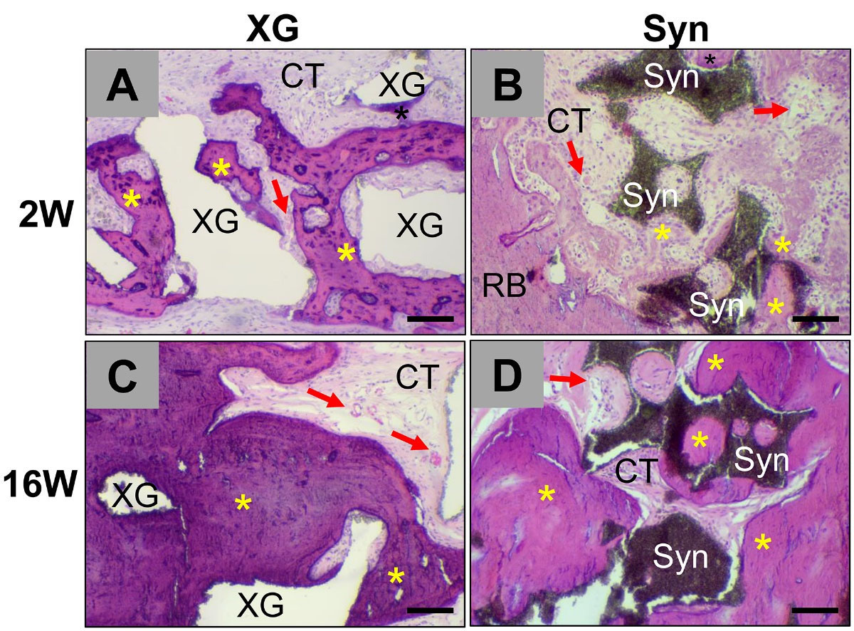 Published Figure 1: xenogenic bone substitute material at left and synthetic bone substitute material at right, at 2 weeks above and 16 weeks below. Original annotations and 100-micrometre scale bars retained.