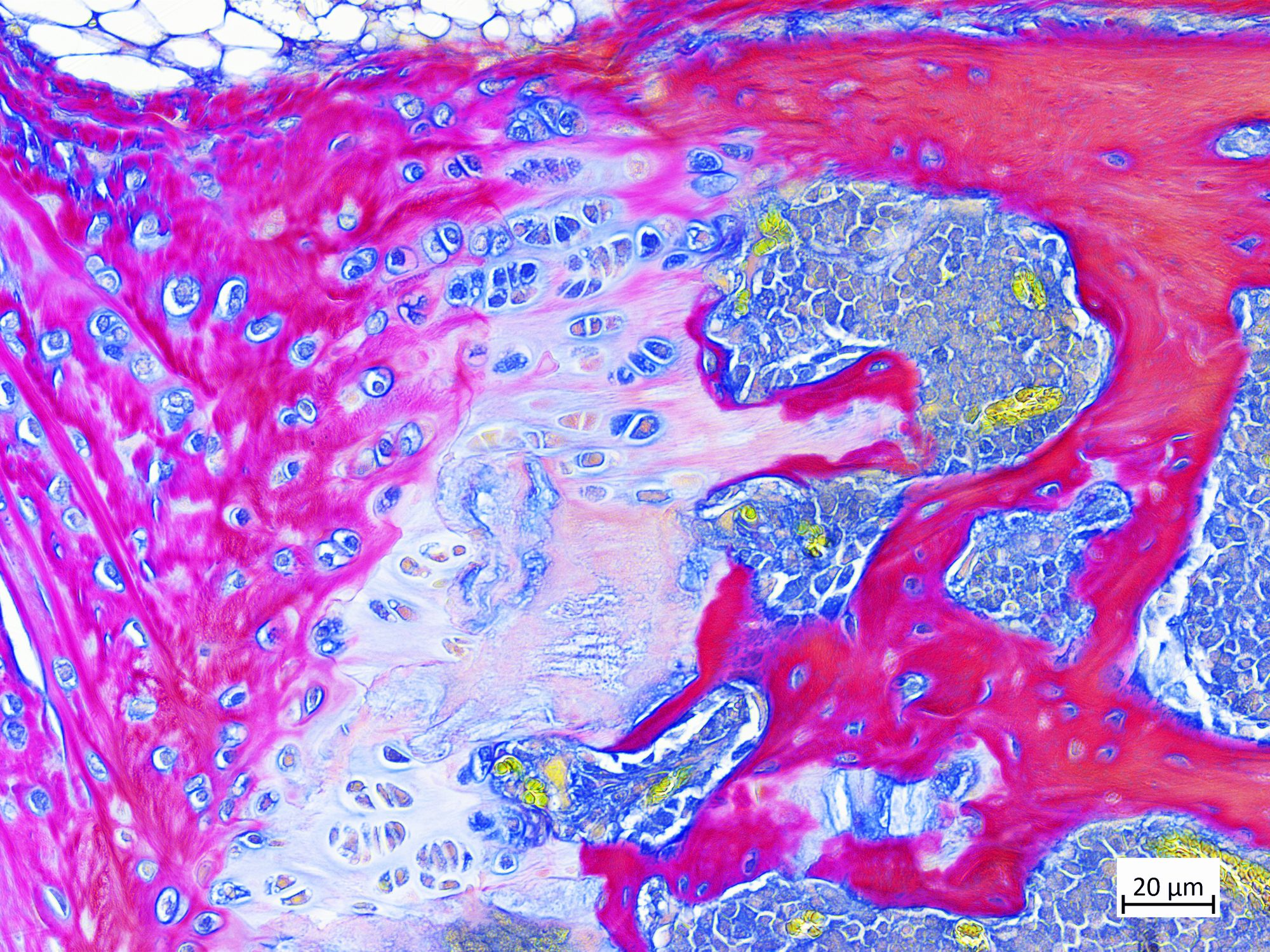Bone and cartilage section
