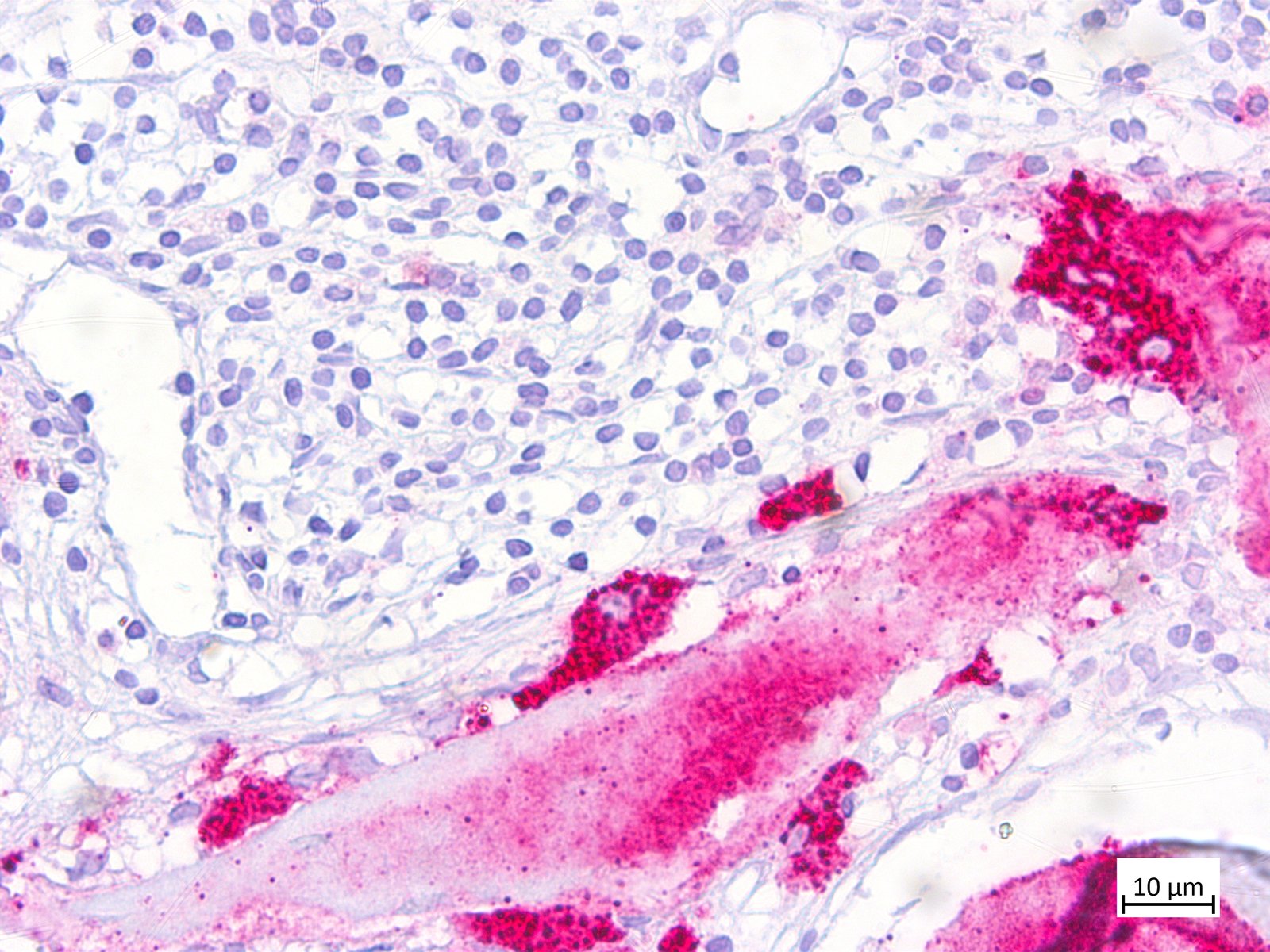 TRAP, osteoclast activity