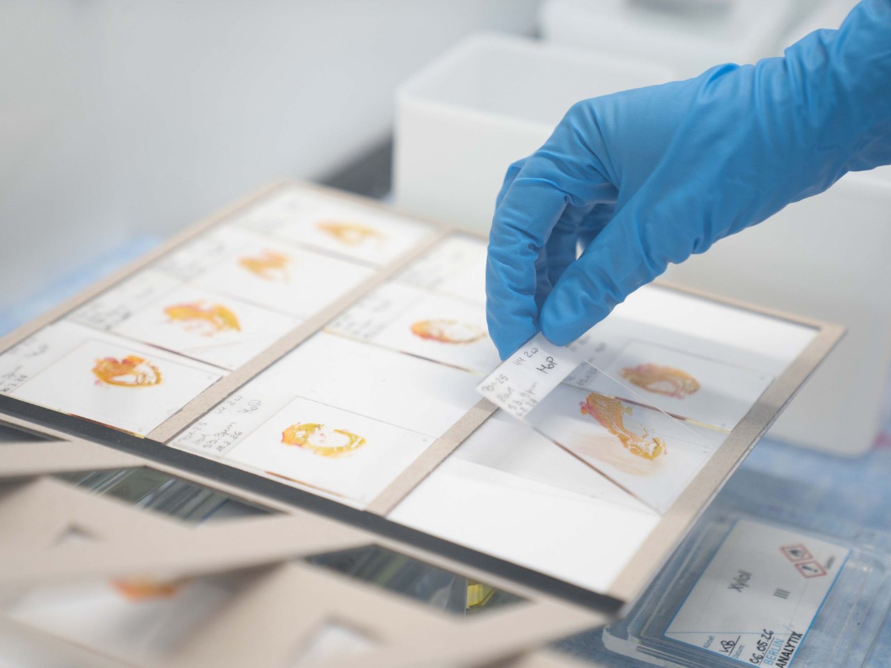 Stained histology slides on a staining rack