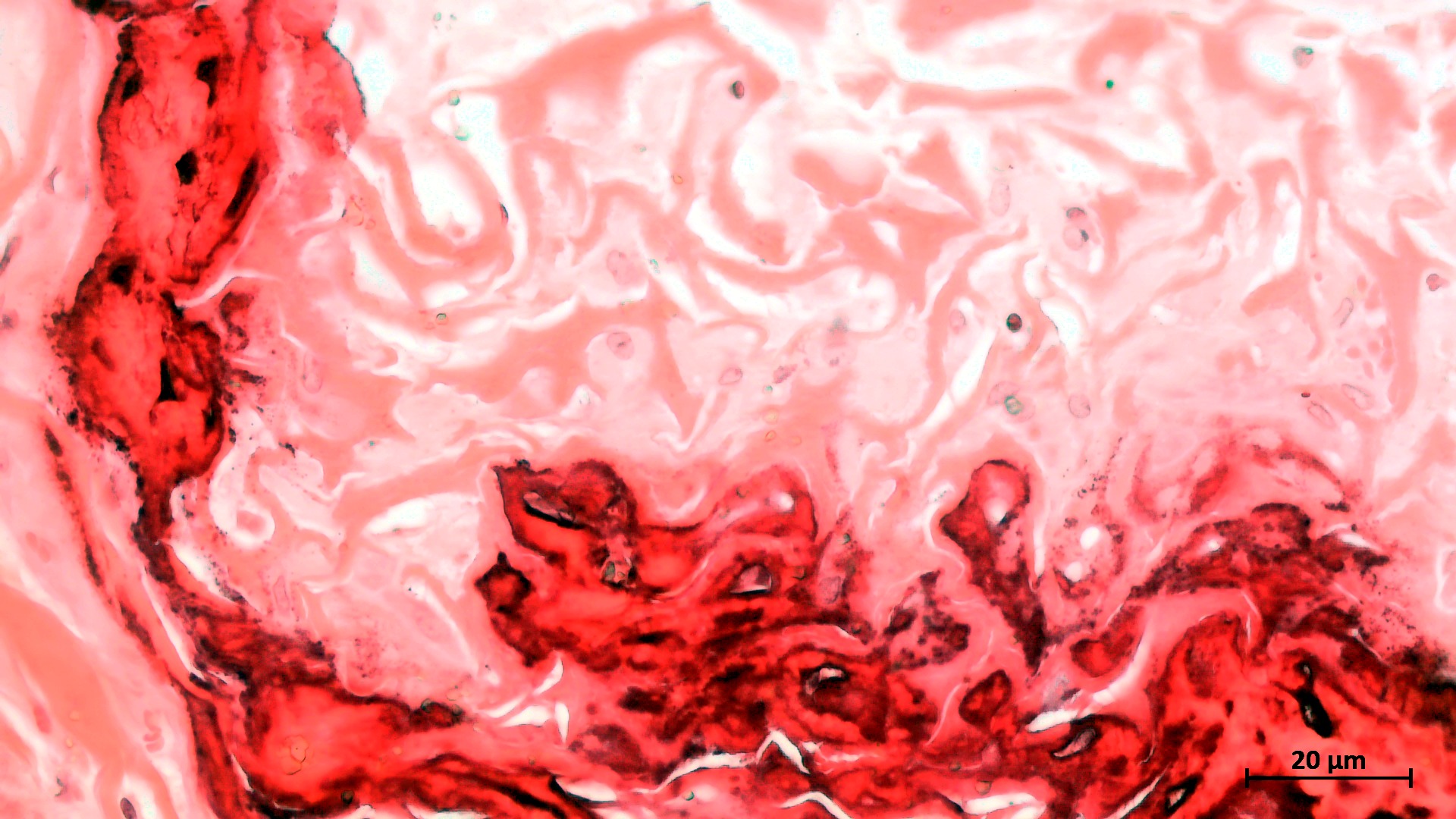 Picrosirius red, collagen