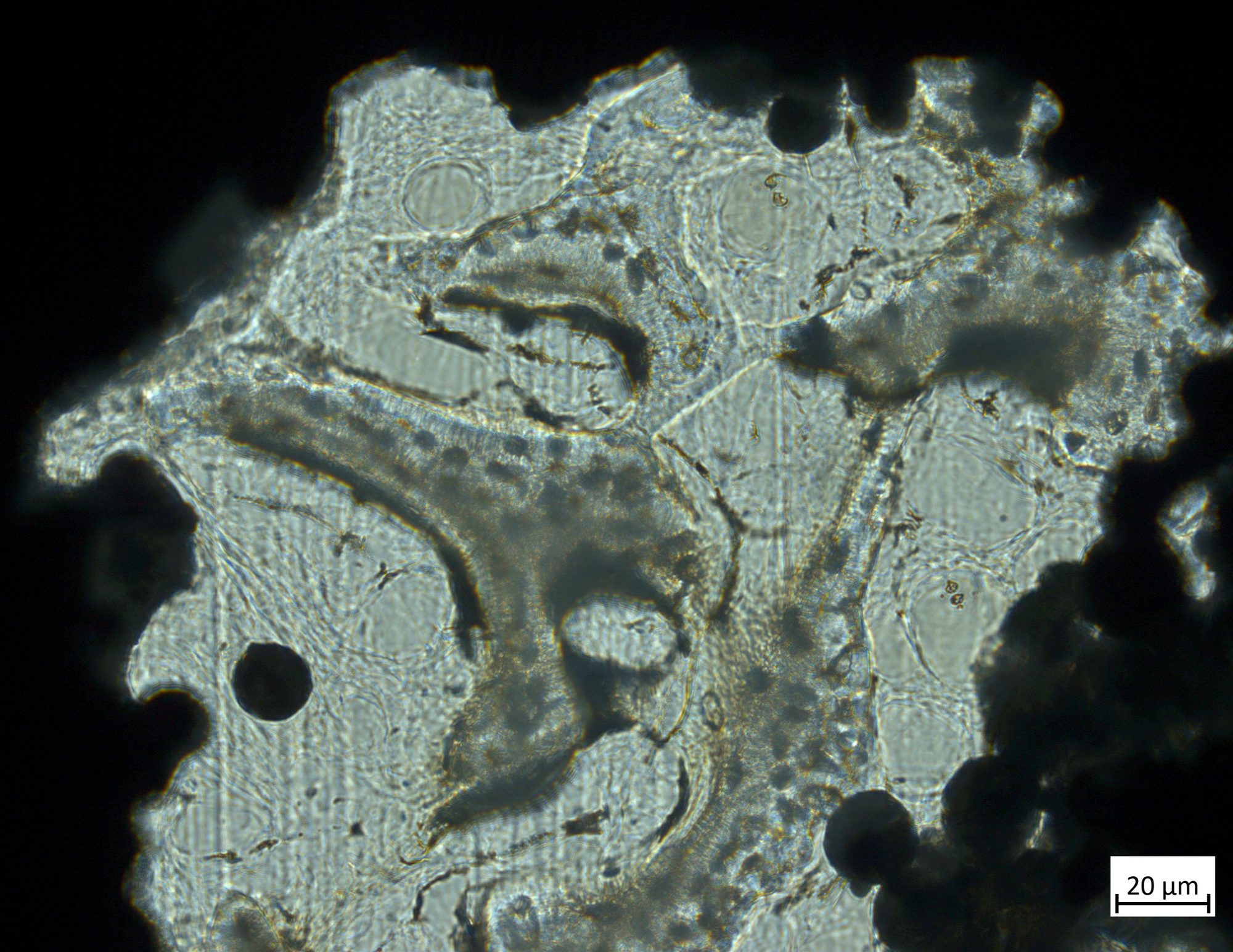 Histology cross-section, resin embedded, 20 µm scale